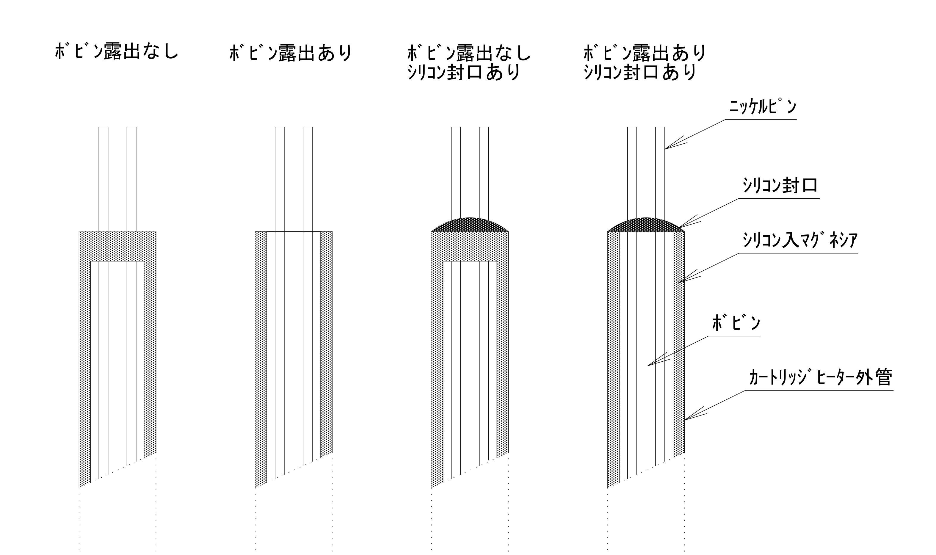 ノーマル
